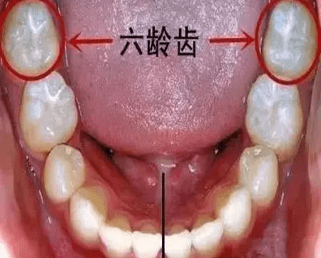 第二磨牙位置图图片