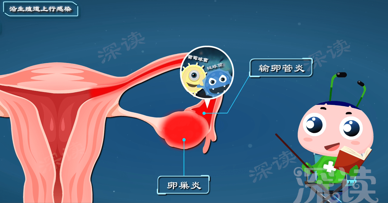 原创
腹痛、白带异常很糟心?做好这四件小事能预防卵巢炎!必看!