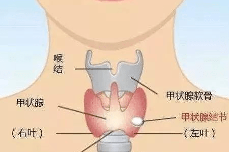 大庆市甲状腺癌占人口的多少_大庆市地图(3)