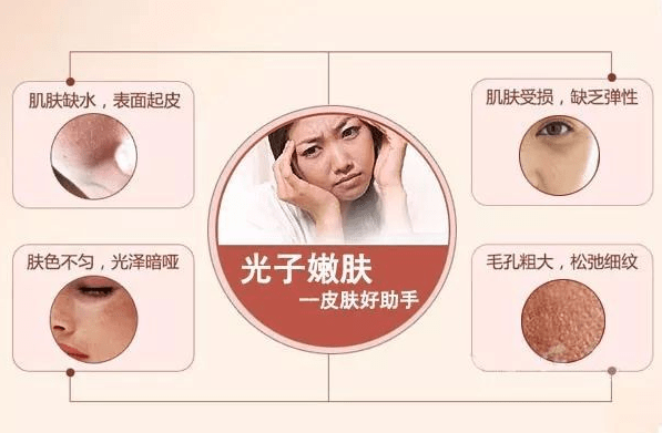 夏天|光子嫩肤？夏天做能让你比别人白10个度？不是吧，我怎么不知道~