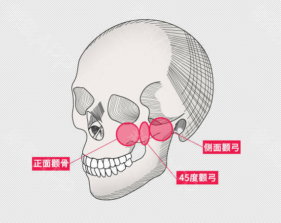 颧骨|圣嘉新颌面外科邱立东介绍高颧骨会让你显老5岁