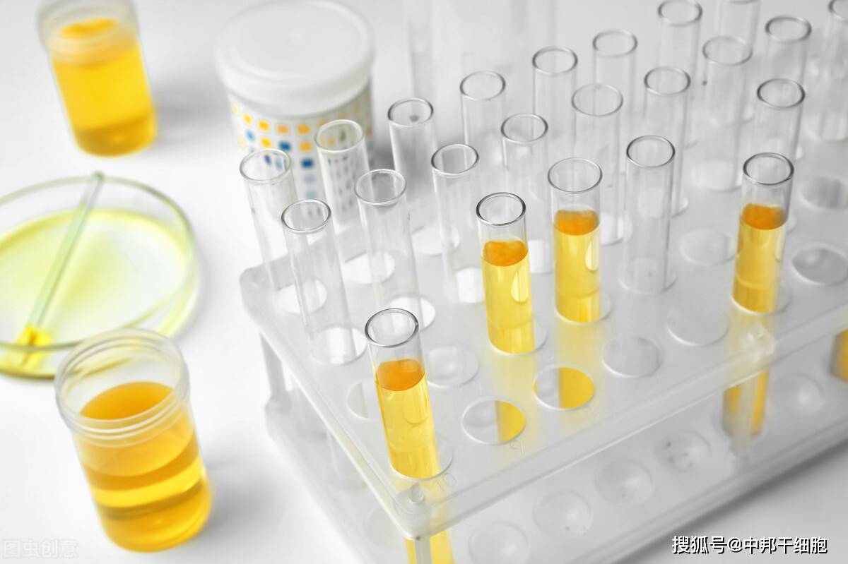 肾脏|干细胞治疗技术帮尿毒症患者康复