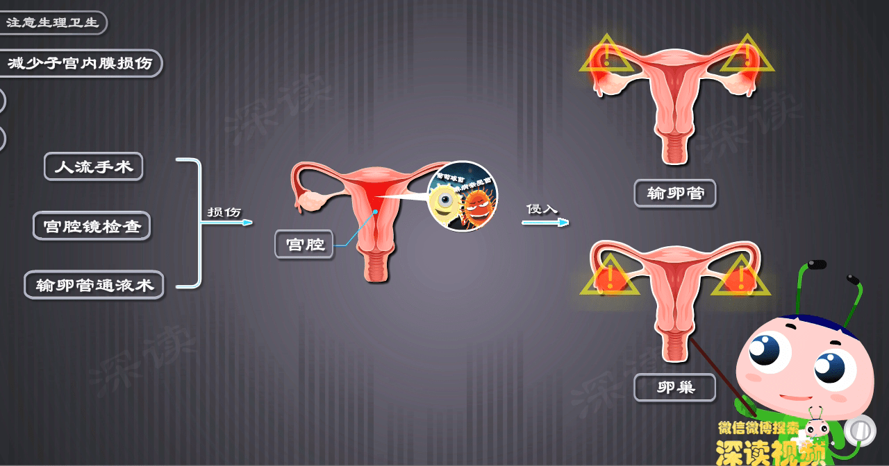 性生活过频,人流惹的祸?硬核干货教你科学预防_阴道