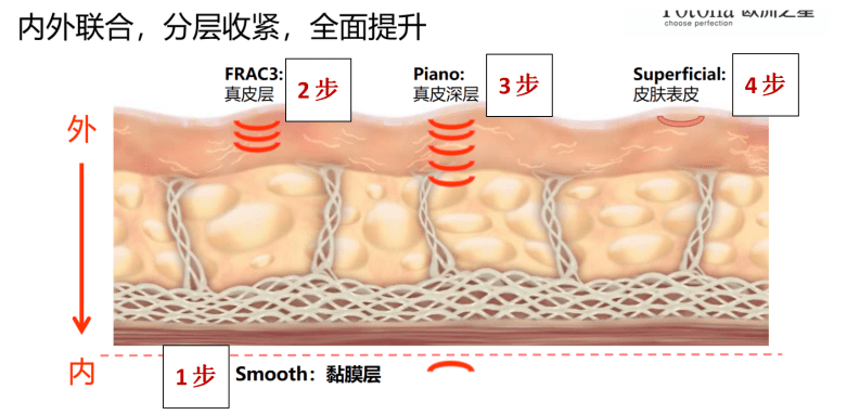 玛吉|林晓曦院长教你热玛吉与fotona4D如何选