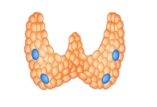 甲状旁腺模式图图片