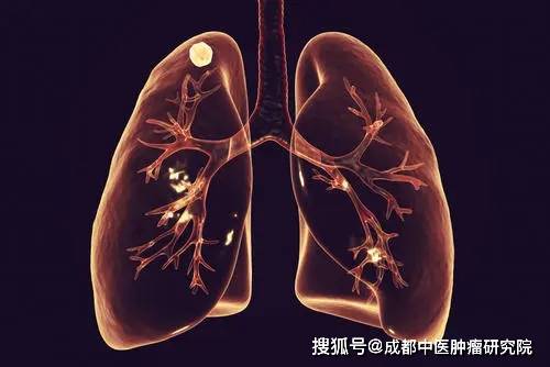 成都中醫腫瘤研究院患上肺腫瘤跟這5個原因有關