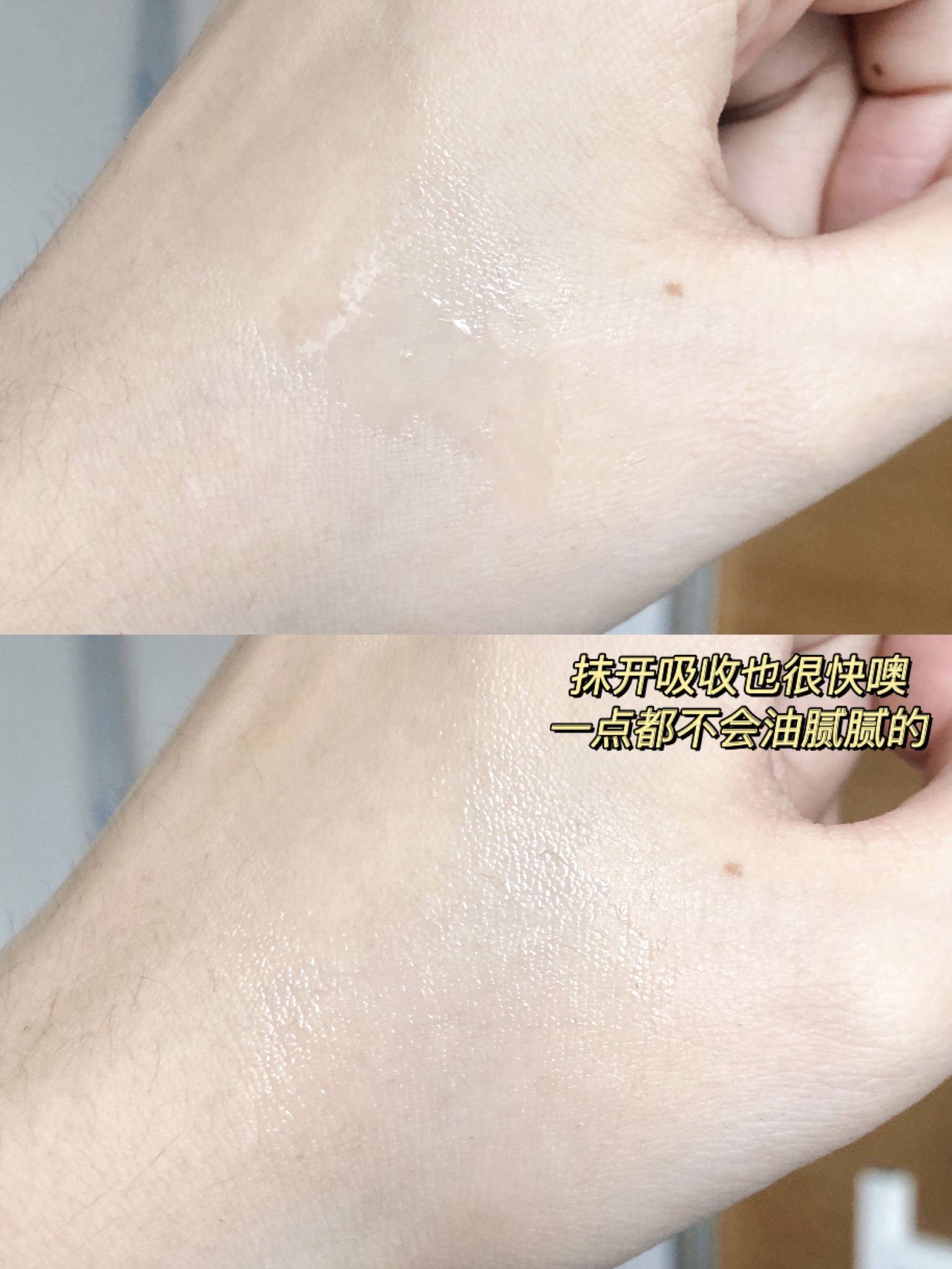 护肤品|换季易过敏？预防趁现在！