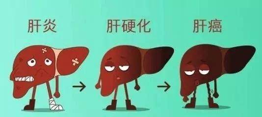 症状|肝硬化有哪些症状？干细胞能治肝硬化吗？