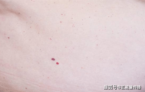 肝脏|肝癌并非“毫无征兆”,医生:身体往往这有5“提示”,别无视它们