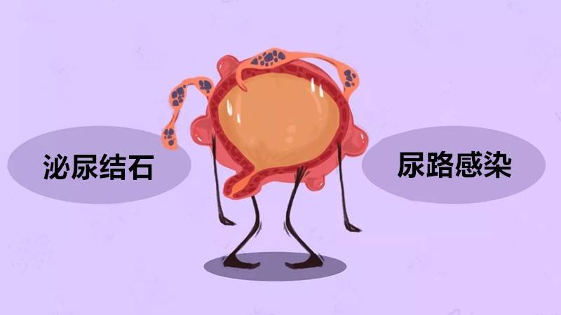 赶紧喝杯水压压惊这些养出肾结石的坏习惯居然全中了