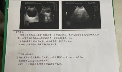 手术|武汉仁爱医院专业妇科：十几年不做妇检，一女性痛失一侧卵巢