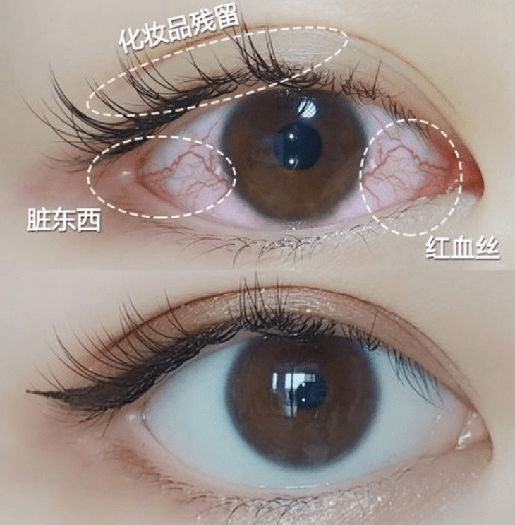 fb870321e8854c7db7efe5ec5a2b33e8.png