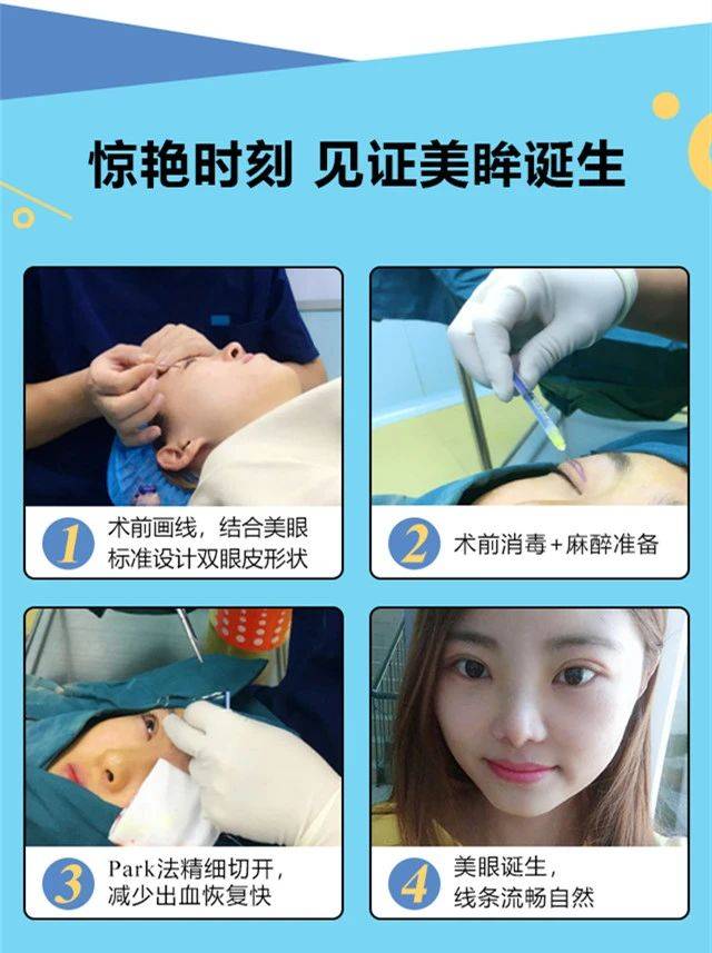 制定方案|温州艺星整形：我的双眼皮贴把男朋友吓到了！