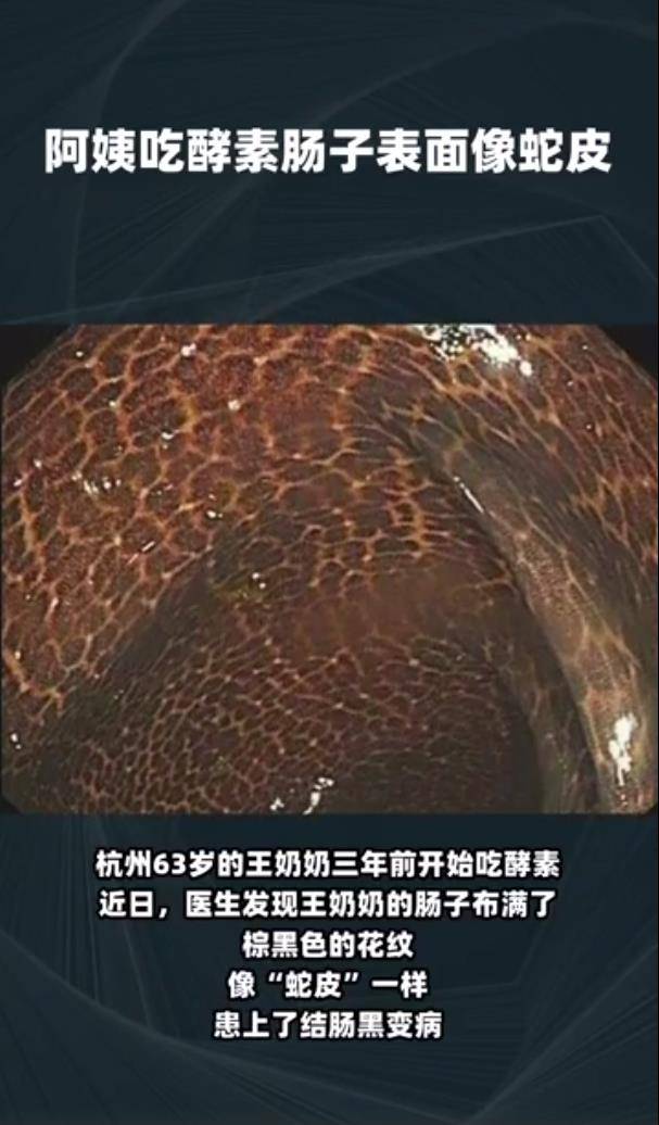 吓人阿姨吃3年酵素肠子表面像蛇皮