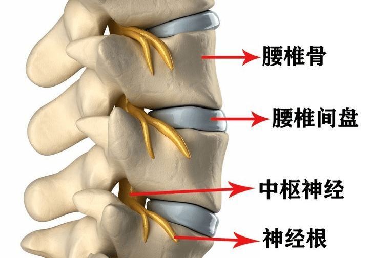 腰椎间盘突出腰小松是如何康复腰突病的