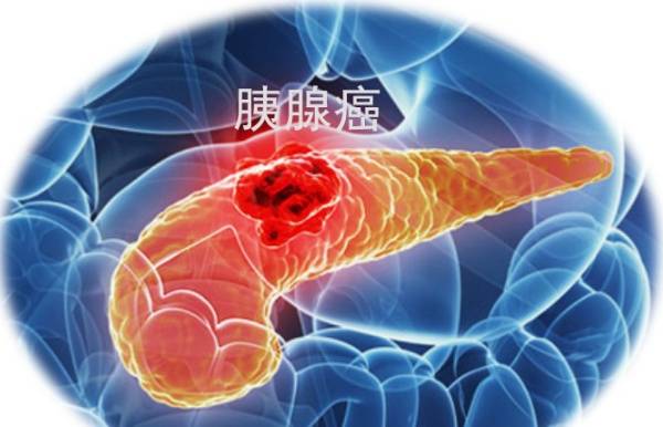 胰腺病怎么看得出来 e55f4097a5254326845b51ad5767d44e.jpeg