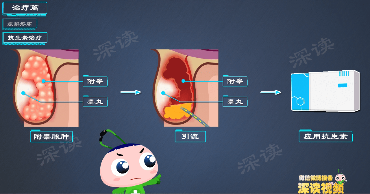 原创蛋疼肿胀该咋办细数附睾炎治疗那些坑小心毁于一蛋