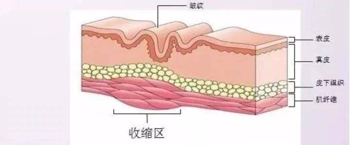 活动窦骁抬头纹像大叔，陈德容皱纹显老，不抗皱颜值再高也扛不住！