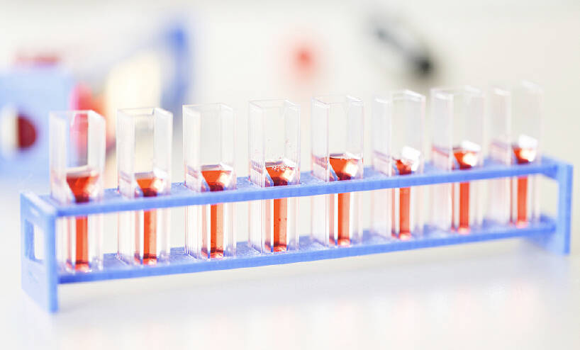 nk细胞免疫疗法让乳腺癌细胞无处可逃百龄nk免疫细胞