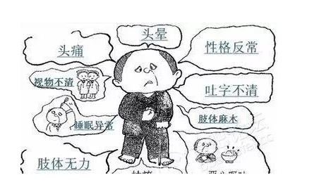 癥狀|中風后遺癥有哪些