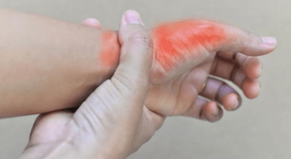 内脏|尿酸高的人，3种食物要忌口，做好2件事，或能避免肾衰竭，需重视