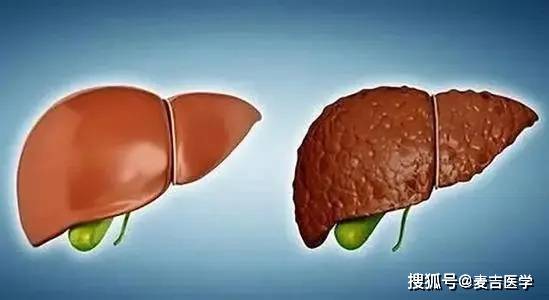 养护|一天之中养护肝脏的3个“黄金时刻“，掌握它们，远离肝脏疾病