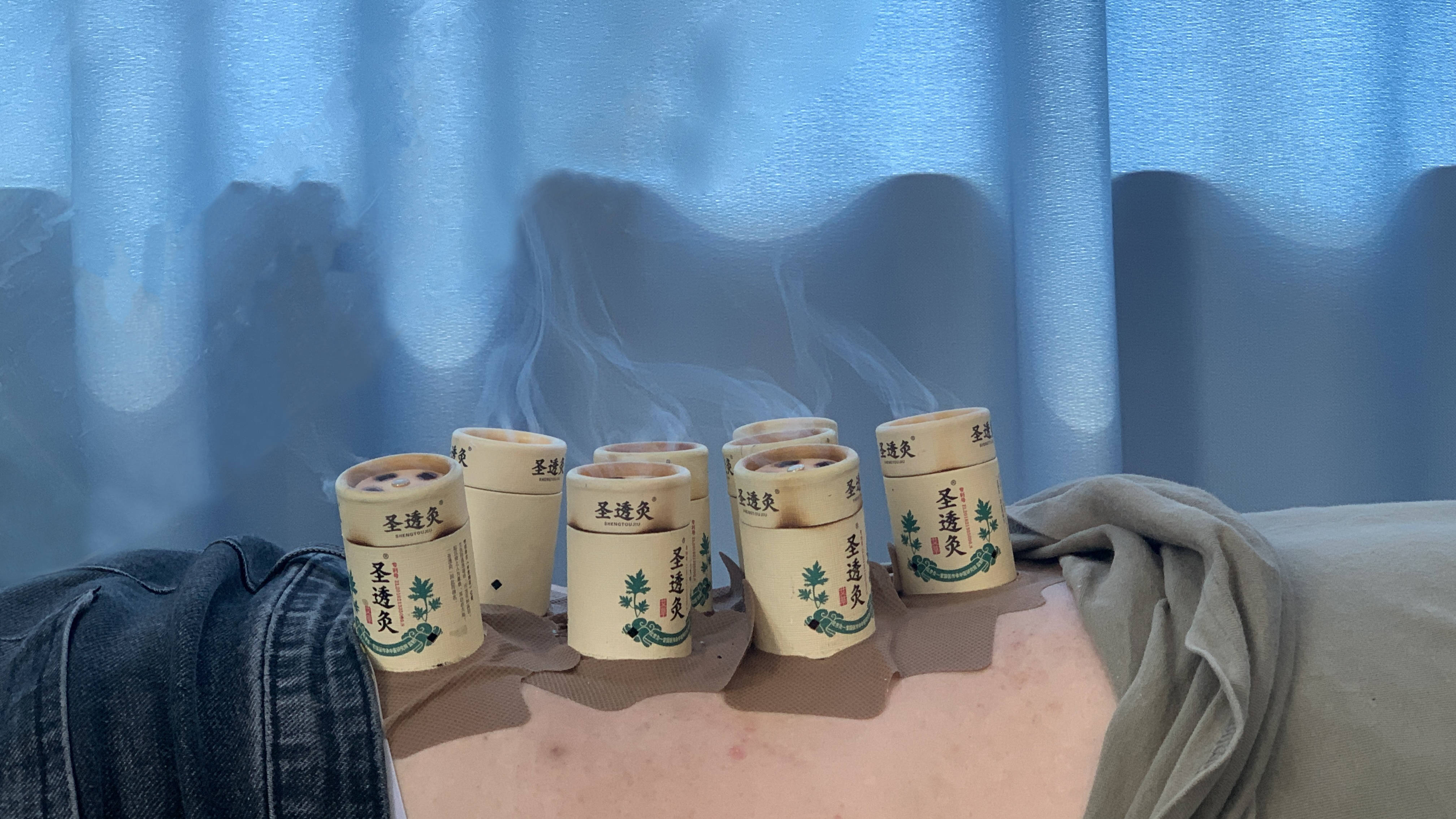 2021圣透三九灸开始啦女性朋友们好好艾自己