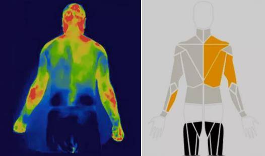 人体温度红外线图图片