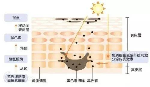 严重ME小白饮丨想靠美白针美白？你真没必要以身犯险！