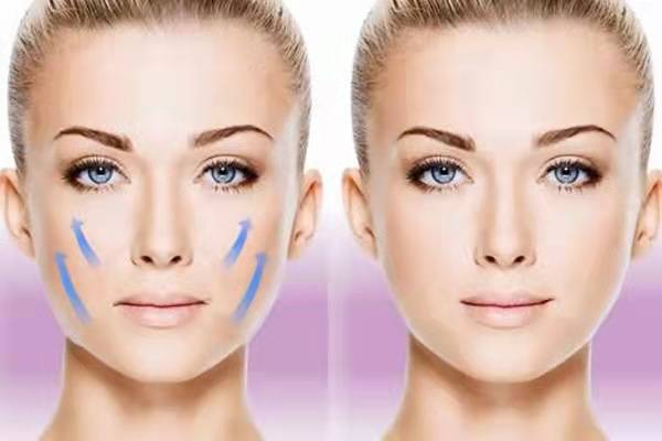脸部脸部做大拉皮可以挺几年,脸拉皮手术能维持几年~