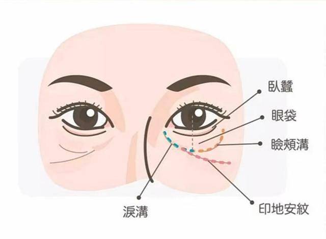 什么印第安纹 泪沟的区别，Summerccici老师为你讲解一下