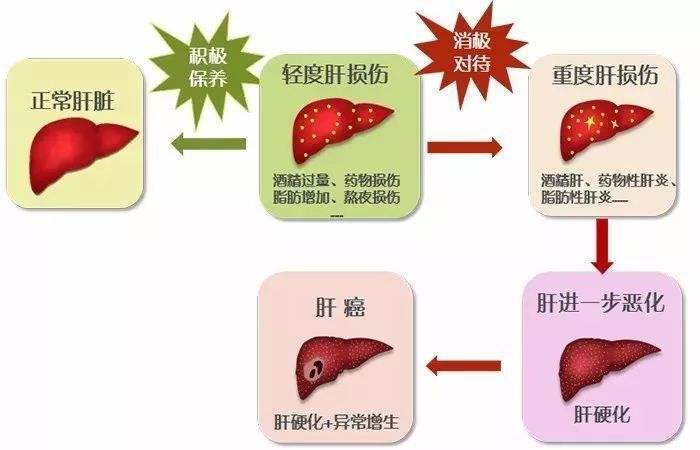 严重|乙肝严重吗，这点是你现在需要了解的。