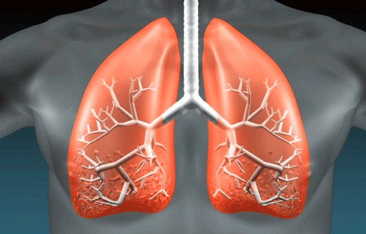 风湿|赵自冰医生：肺纤维化与哪些因素有关？