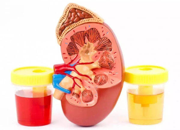 iga肾病是什么类型的疾病 539405ee9888401bbadf28d04533ece4.jpeg