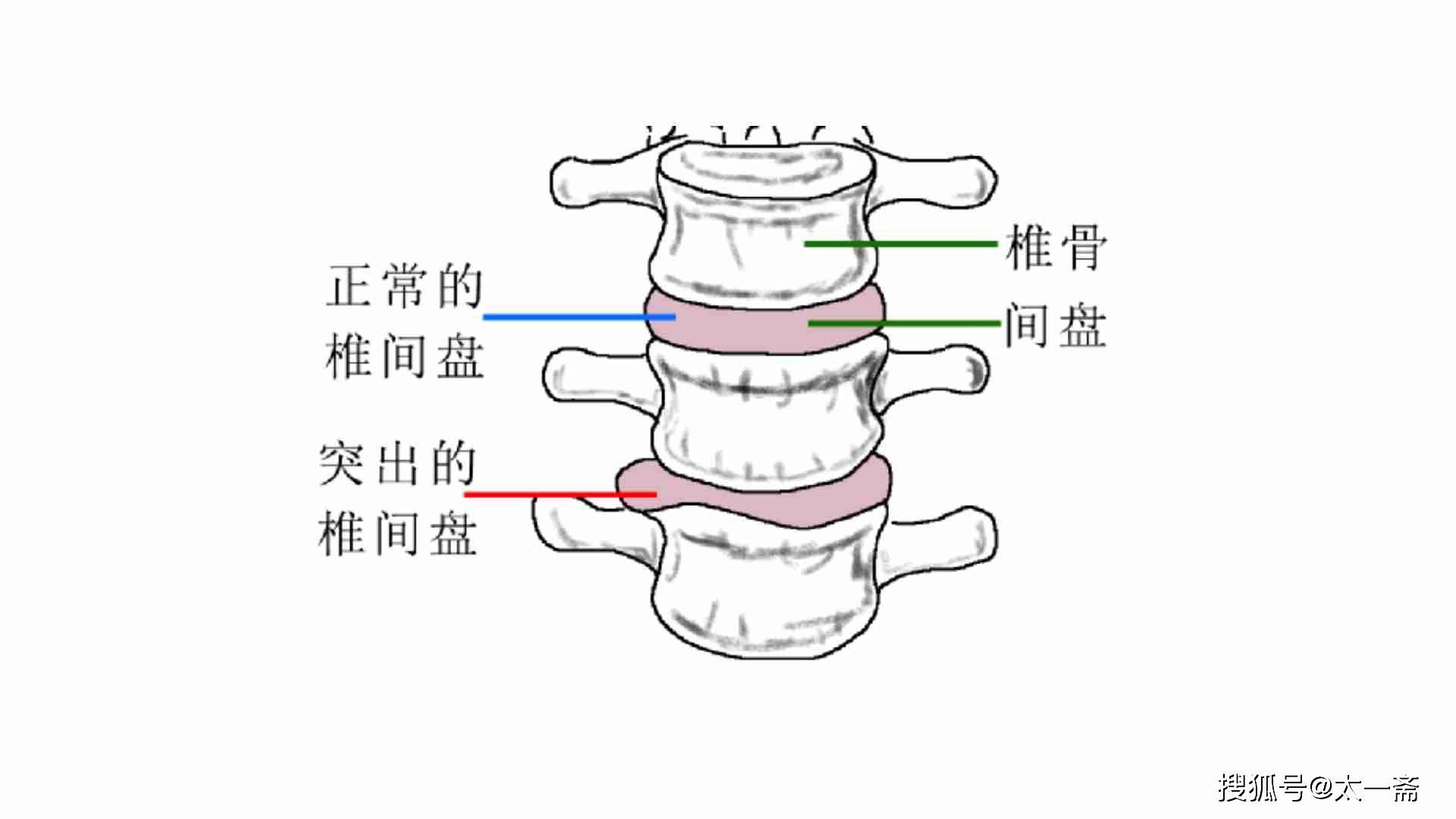 腰椎间盘位置图解图片