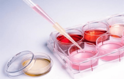 什么大科普:干细胞去皱纹能挺几年?干细胞去皱有什么副作用?