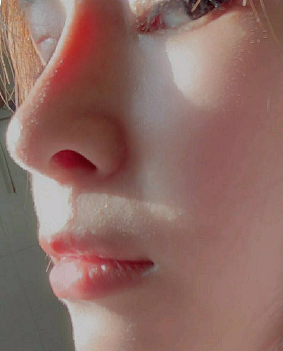 foho我做假体隆鼻出现后遗症了，真的后悔了