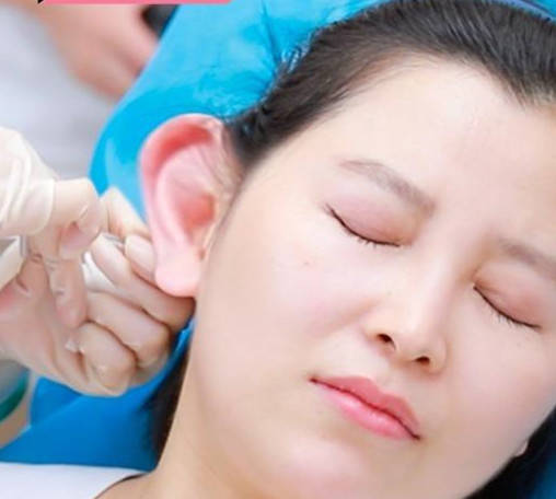 网红跟风整成精灵耳却不知其隐藏的风险竟这么大