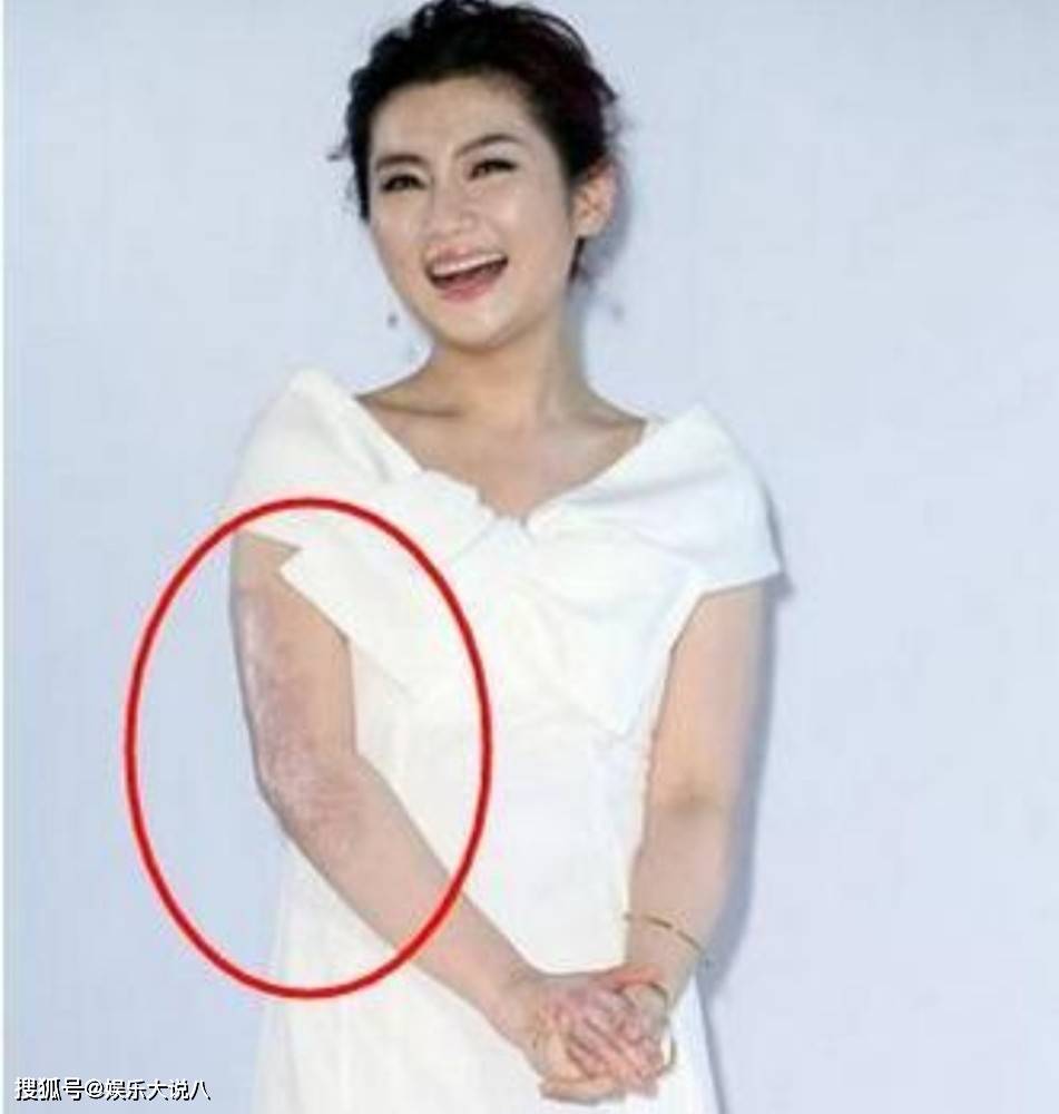 原创事业巅峰被烧伤遭前夫嫌弃40岁selina与小7岁男友恋爱细节甜到不