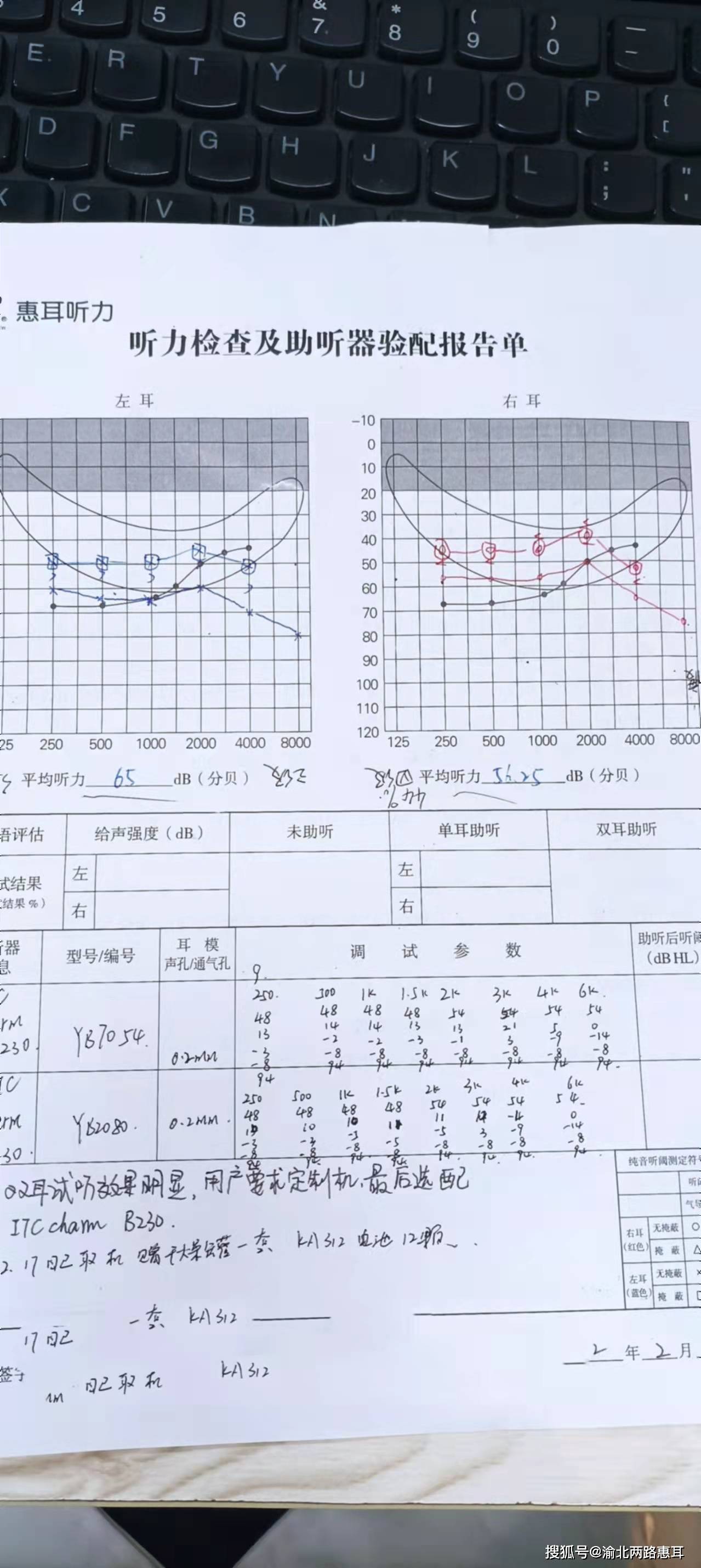 渝北双凤路验配中心分享:3月给母亲最好的礼物——带她去配助听器