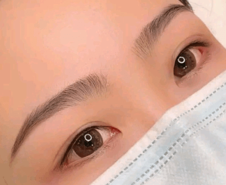 进行纹眉后奇痒无比，到底该咋办呢？|栖桐