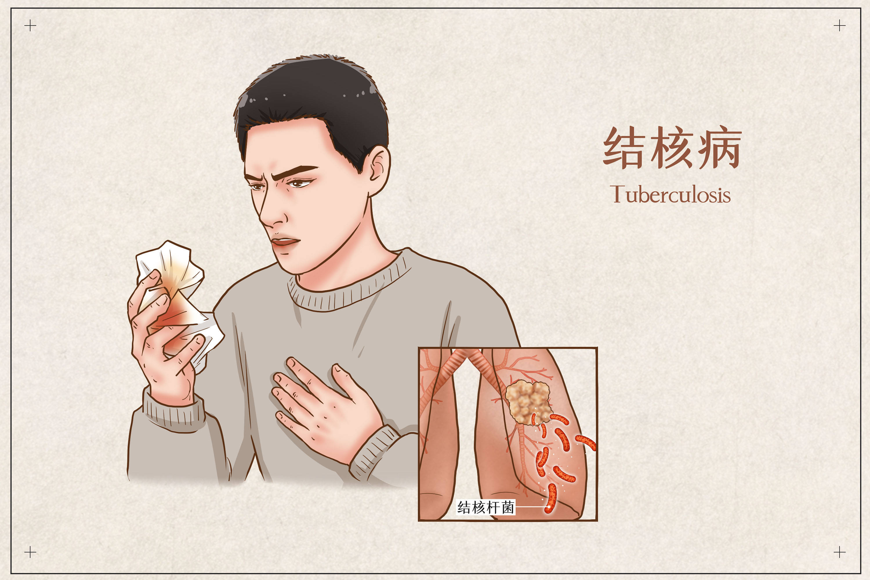 肺结核图片卡通图片图片