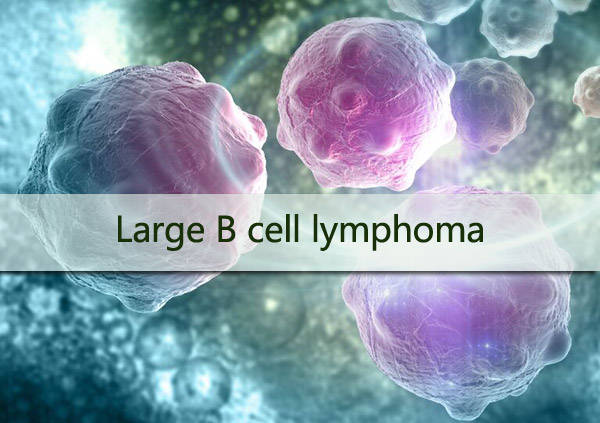 这种最常见的淋巴瘤,迎来二线car-t疗法_治疗_患者_细胞