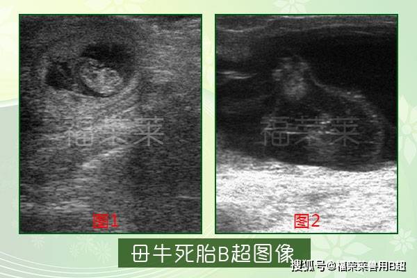 怀孕25天b超孕囊图图片