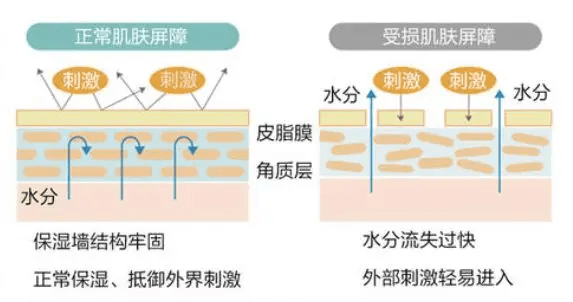 維生素b5能修復皮膚屏障受損嗎維生素b5對皮膚角質層薄有修復作用嘛