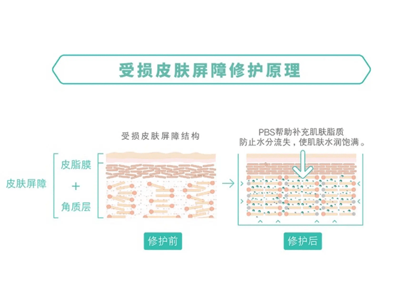 一,關於皮膚屏障皮膚屏障主要由皮脂膜和角質層組成.