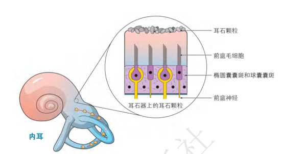 耳石脱落示意图图片