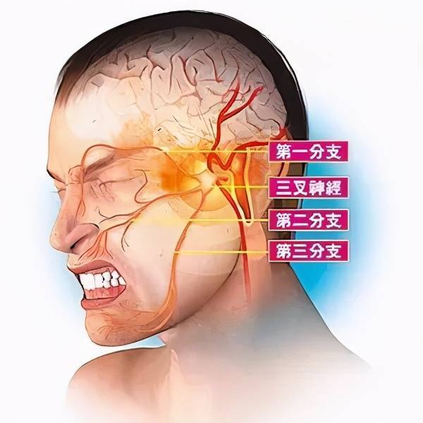 三叉一的准确位置图图片