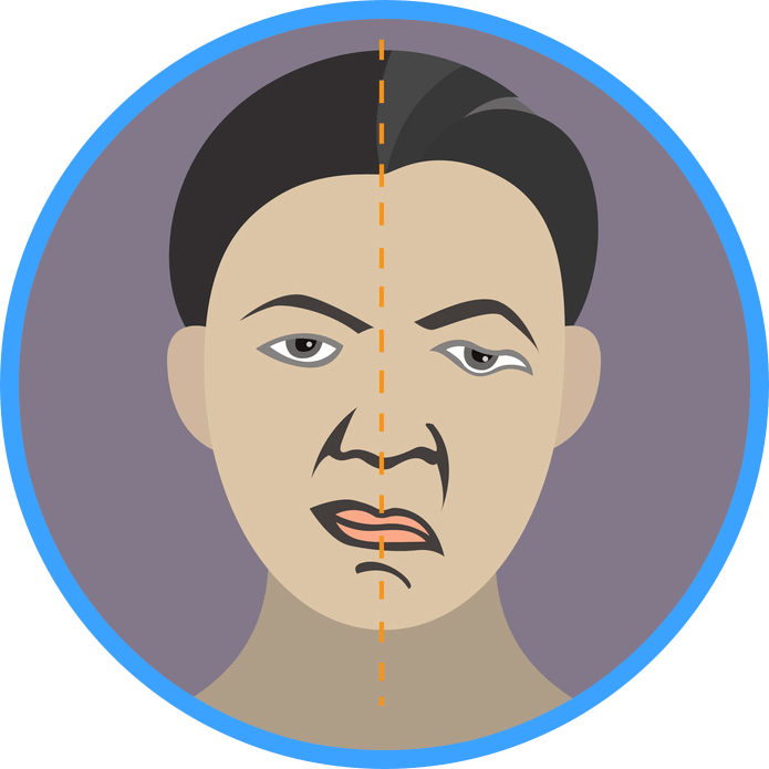 济南军颐医院:哪些原因会诱发面瘫?_患者_面神经_肿瘤性