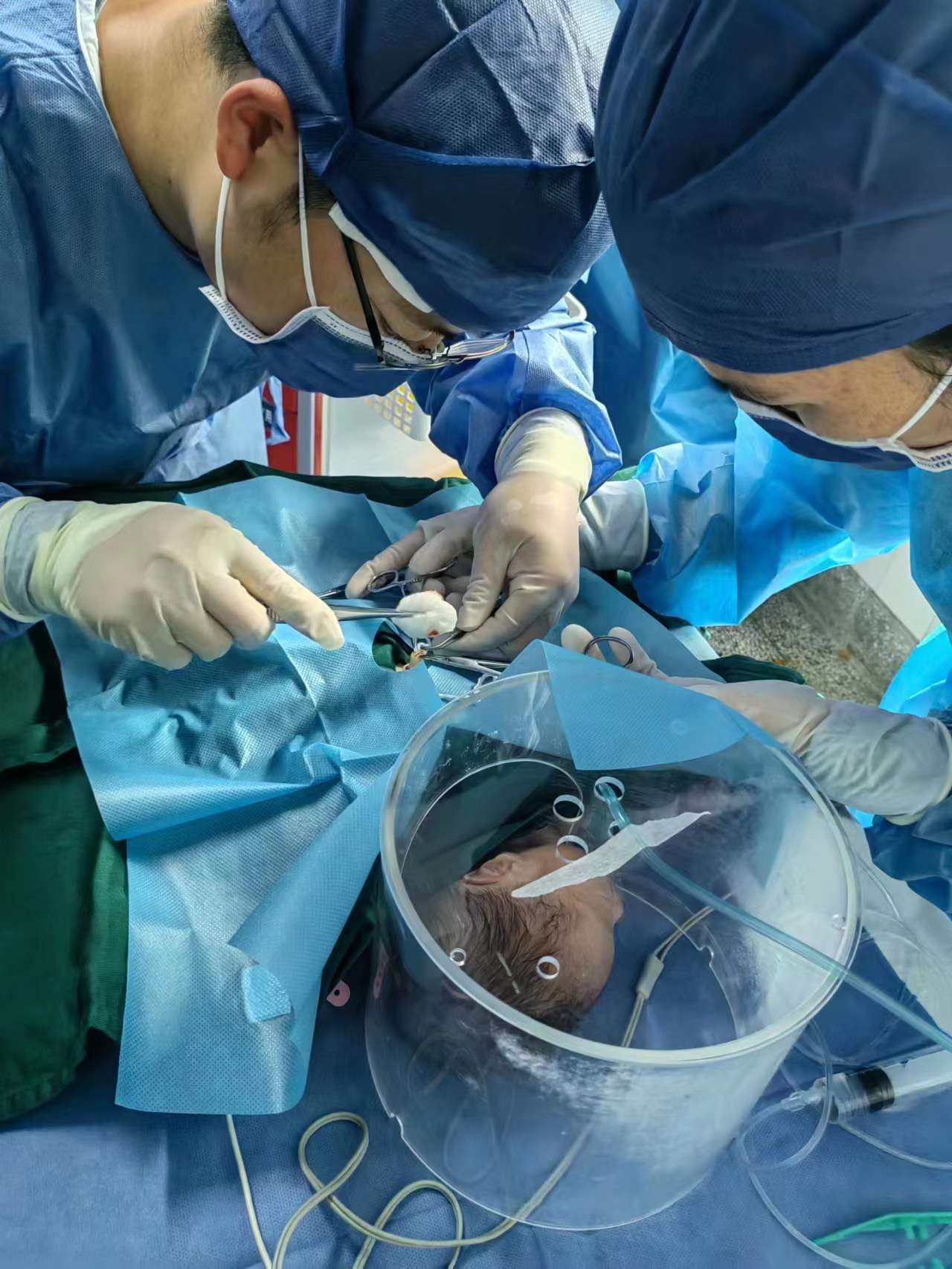 商丘市中心医院成功开展新生儿经脐深静脉置管